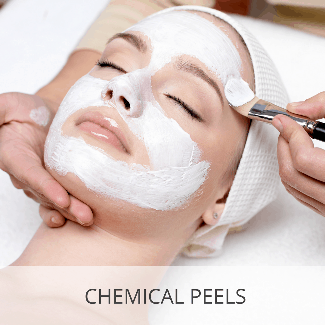 Are Chemical Peels Really That Effective?