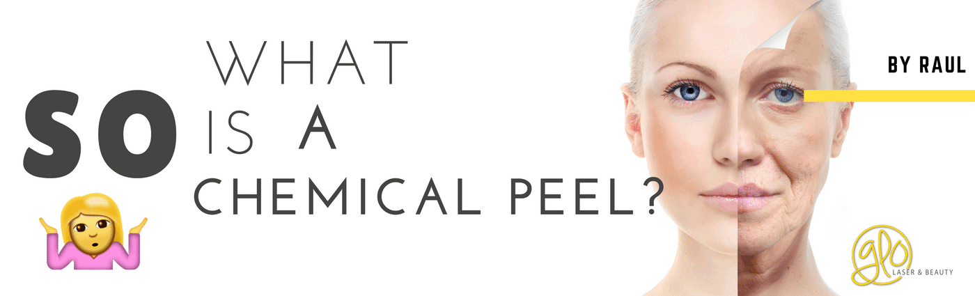 So what is a chemical peel?