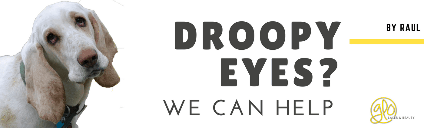 Droopy Eyes? Help is on it's way