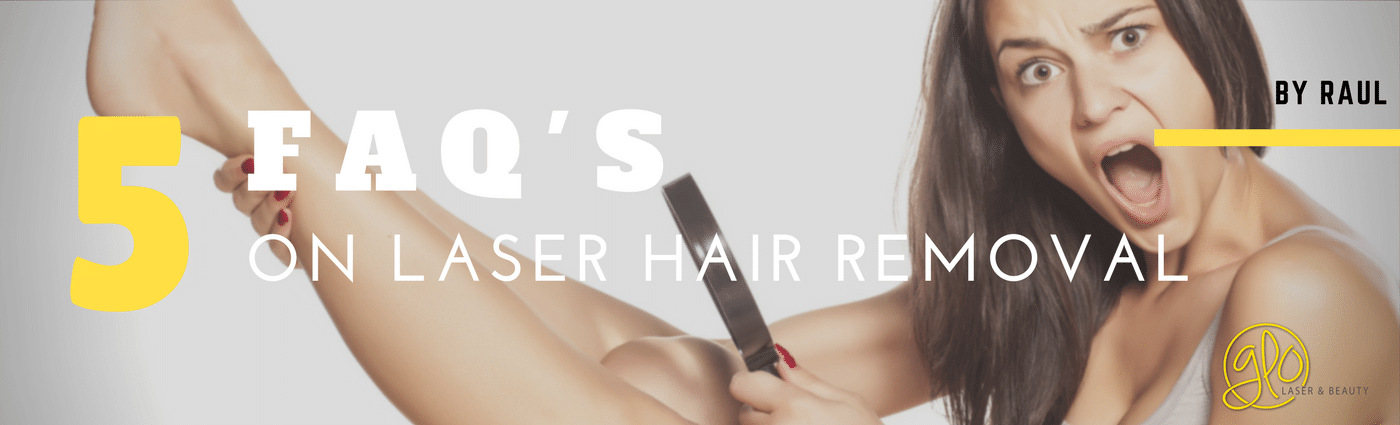 5 Laser Hair Removal FAQ's : Answered