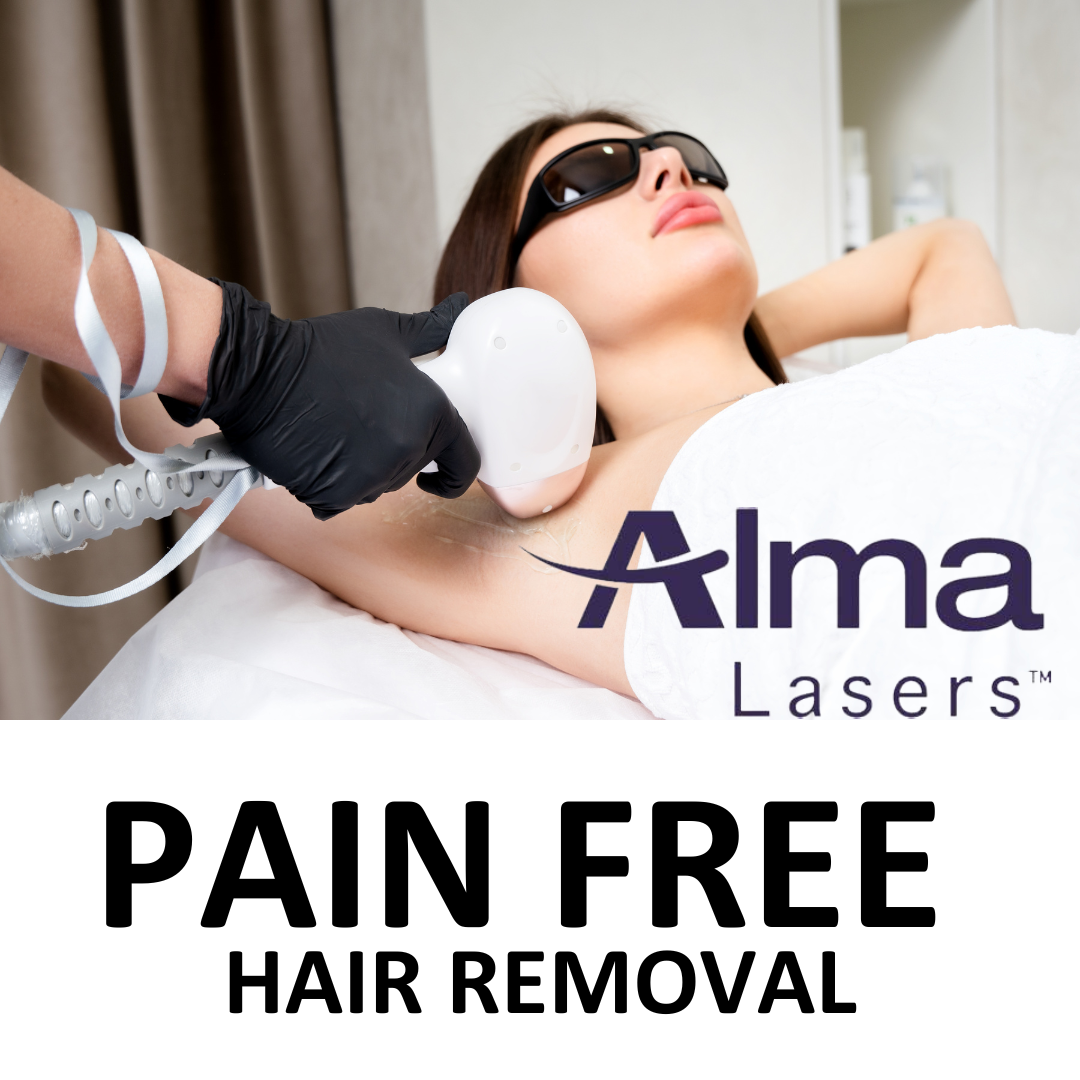 ALMA - Pain Free Hair Removal