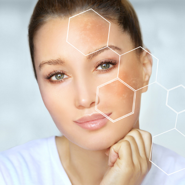 Lipo Lab PPC - Fat Dissolving Injections